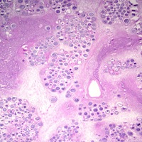 3844_1_liver_a_ichycropped.jpg